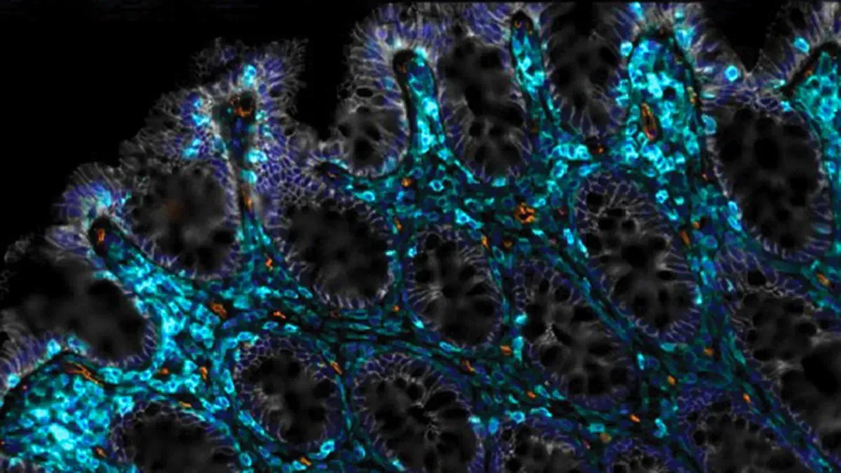 Microscopic view of intestinal tissue showing improved regeneration after CAR T-cell therapy in aging mice