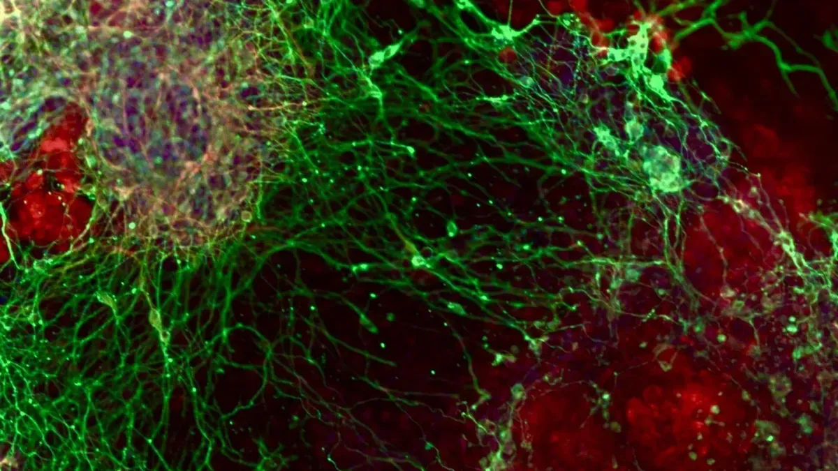 Microscopic view of neural cells derived from stem cells, highlighting genetic research in brain development