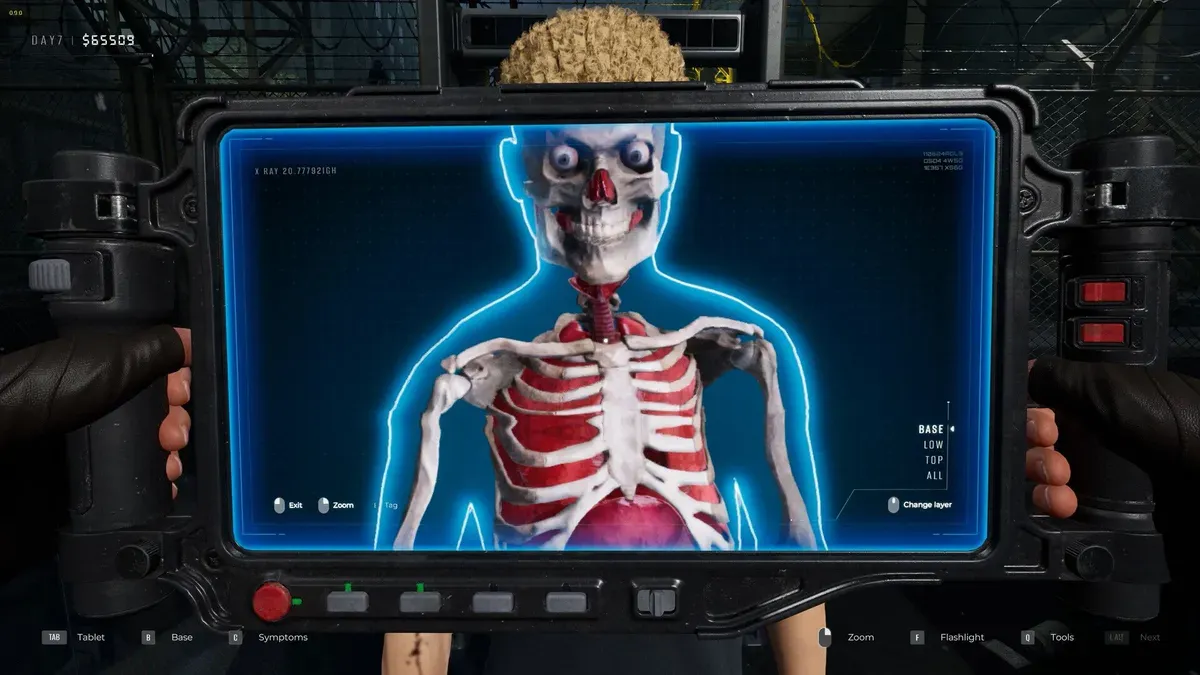 Quarantine Zone's X-ray scanner reveals a hand grenade lodged in a player's rectal region.