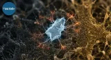 Microplastics Linked to Brain Inflammation Pathways in Alzheimer’s and Parkinson’s Models