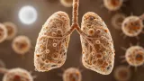 Aging Lung Cells Trigger Runaway Inflammation That Turns Mild Flu Severe